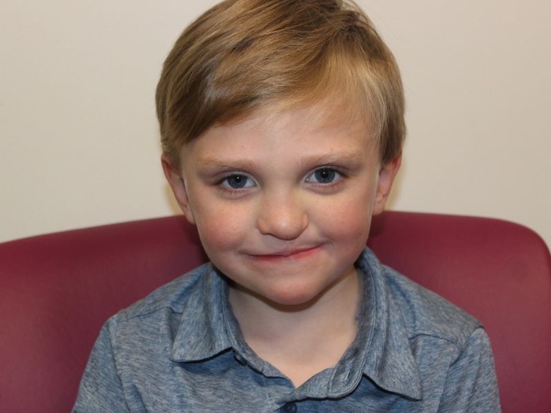 A boy who has had surgery for cleft lip.